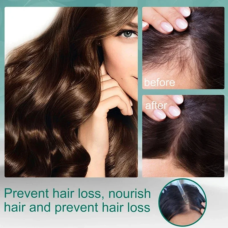 トリートメントリキッド フォーハーブ 天然成分 育毛剤 血清 - Hair Care Natural Ingredients のレビューと価格