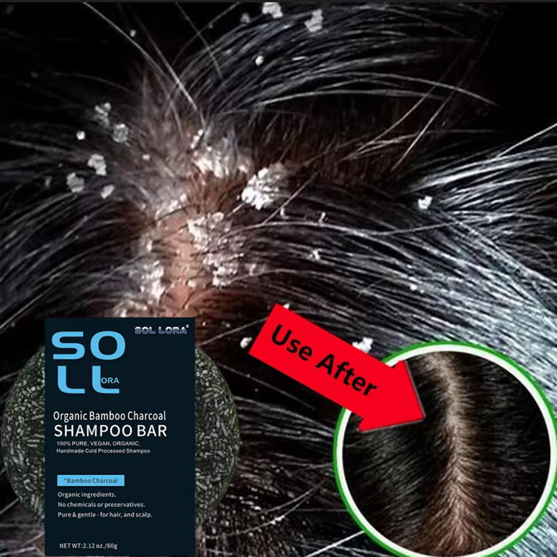 高速抗フケヘアトリートメント石鹸かゆみ修復頭皮クリーニング角 - Hair Care Dandruff のレビューと価格
