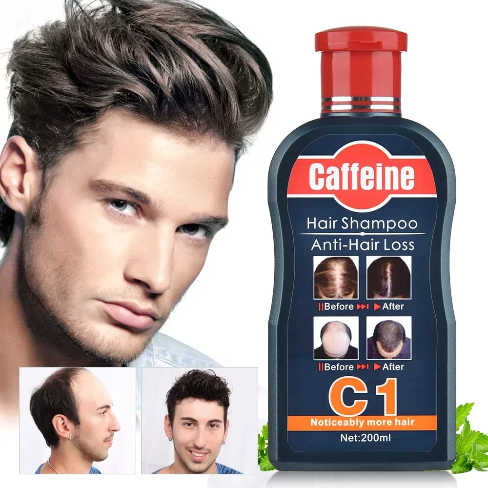 男性シャンプー育毛のための天然植物カフェイン抗脱毛フケ栄養ケ - Hair Care Korean Products のレビューと価格